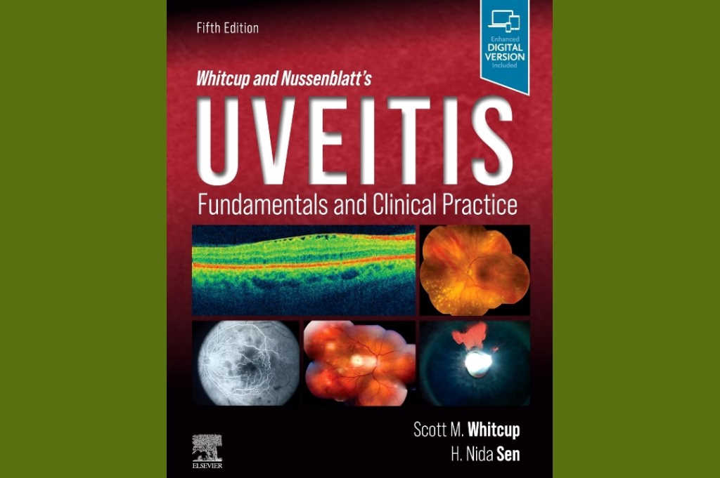 BOOK REVIEW: Whitcup and Nussenblatt's Uveitis 5th edition by Scott M Whitcup and H Nida Sen