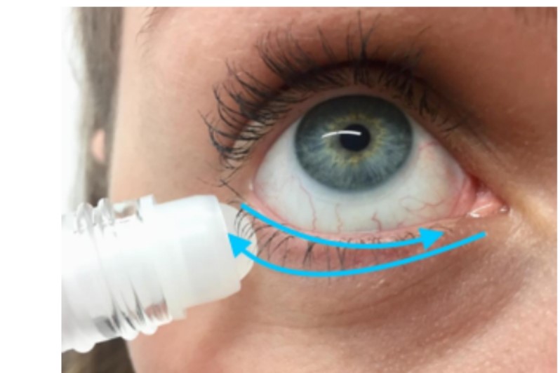 Castor oil for blepharitis eyeonoptics