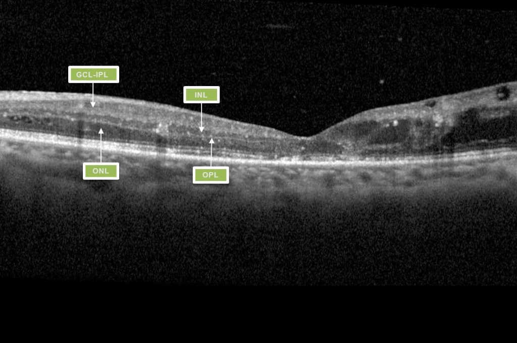 Contemporary approaches to assessing and treating diabetic eye disease